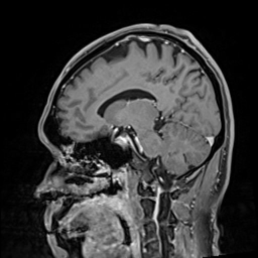 Click on the Serie image to view the images of VILLANUEVA, WILLIAM A.